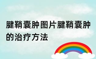腱鞘囊腫圖片,腱鞘囊腫的治療方法