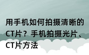 用手機(jī)如何拍攝清晰的CT片?手機(jī)拍攝光片、CT片方法