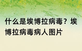什么是埃博拉病毒?埃博拉病毒病人圖片
